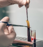 הזרקת דבק פיברין - תמונת אווירה